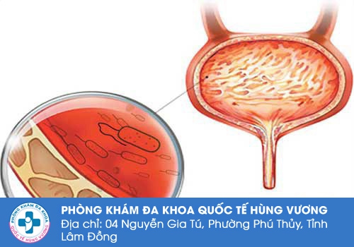 Địa chỉ khám bàng quang tốt ở TPHCM Địa chỉ khám bàng quang tốt ở TPHCM